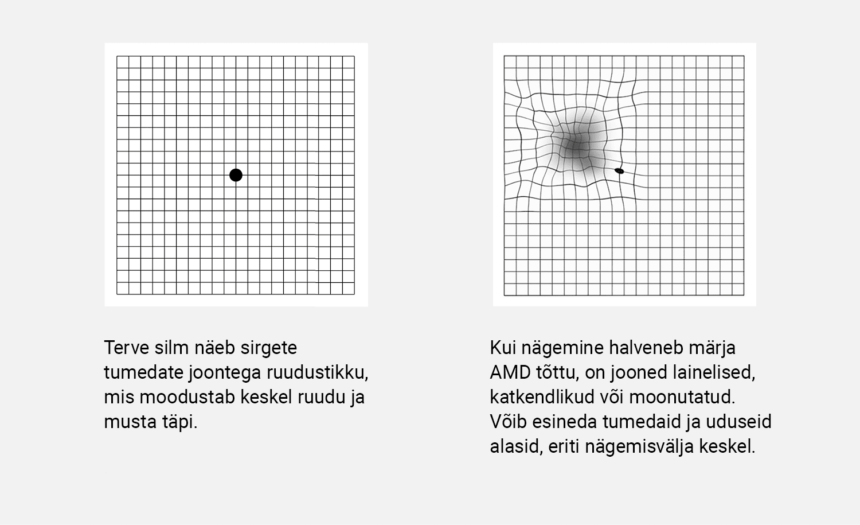 Enesekontrolliks sobib lihtne ruudustik - Amsler test. 